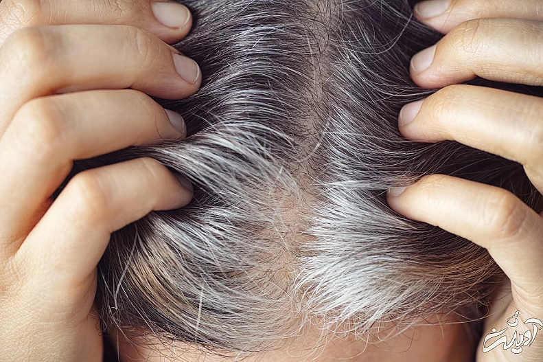 چرا نباید موهای خاکستری یا سفید را از ریشه بکنید؟